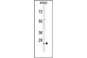 Western blot analysis of MCART2 Antibody (N-term) in K562 cell line lysates (35ug/lane). (MCART2 Antikörper  (N-Term))