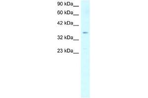 SCD antibody used at 1 ug/ml to detect target protein. (SCD Antikörper)