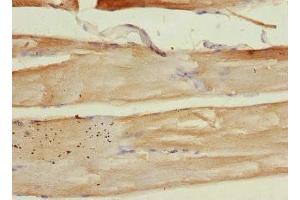 Immunohistochemistry of paraffin-embedded human skeletal muscle tissue using ABIN7149412 at dilution of 1:100 (PLA2G4C Antikörper  (AA 1-189))