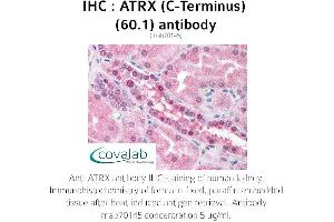 Image no. 1 for anti-RAD54-Like (RAD54L) (AA 1-300) antibody (ABIN1723093) (RAD54L Antikörper  (AA 1-300))