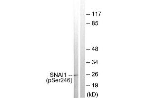 Western blot analysis of extracts from HT29 cells, using SNAI1 (Phospho-Ser246) antibody. (SNAIL Antikörper  (pSer246))