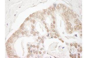 Immunohistochemistry (IHC) image for anti-G Protein-Coupled Receptor Kinase Interactor 2 (GIT2) (AA 500-550) antibody (ABIN7453500)