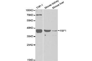 Western blot analysis of extracts of various cell lines, using FBP1 antibody (ABIN5973135) at 1/1000 dilution. (FBP1 Antikörper)