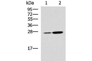 Western blot analysis of Mouse kidney tissue and Mouse liver tissue lysates using NQO2 Polyclonal Antibody at dilution of 1:1000 (NQO2 Antikörper)