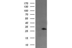 Image no. 1 for anti-Snail Family Zinc Finger 2 (SNAI2) antibody (ABIN1502651) (SLUG Antikörper)
