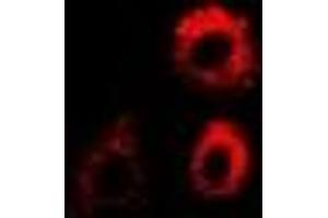 Immunofluorescent analysis of PTRH2 staining in MCF7 cells. (PTRH2 Antikörper)