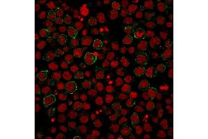 Immunofluorescence staining of PFA-fixed Ramos cells using CD86 Mouse Monoclonal Antibody (BU63) followed by goat anti-Mouse IgG conjugated to CF488 (green).