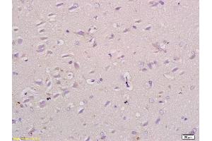 Formalin-fixed and paraffin embedded rat brain tissue labeled with Anti-NPRB/Natriuretic Peptide Receptor B Polyclonal Antibody, Unconjugated (ABIN679778) at 1:200 followed by conjugation to the secondary antibody