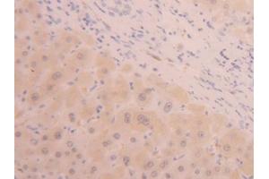 IHC-P analysis of Human Liver Tissue, with DAB staining. (ALT Antikörper  (AA 367-480))