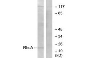 Western blot analysis of extracts from HepG2 cells, using RhoA (Ab-188) Antibody. (RHOA Antikörper  (AA 144-193))