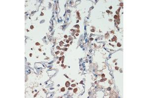 Immunohistochemistry of paraffin-embedded human lung using APC antibody (ABIN1678689, ABIN1678690, ABIN5664154 and ABIN6219837) at dilution of 1:200 (40x lens). (APC Antikörper  (AA 2544-2843))