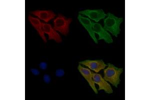 ABIN6257296 and ABIN6275747 staining Hela cells by IF/ICC.