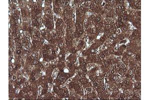 Image no. 4 for anti-Melan A (MLANA) antibody (ABIN1499425) (MLANA Antikörper)