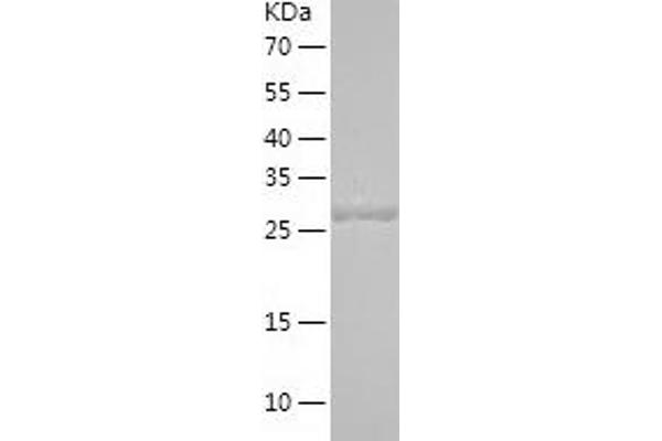 Stanniocalcin 2 Protein (STC2) (AA 25-302) (His tag)