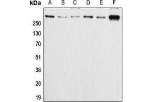 Western blot analysis of APC (pS2054) expression in HeLa (A), Caco2 (B), SW480 (C), MCF7 (D), SP2/0 (E), PC12 (F) whole cell lysates. (APC Antikörper  (pSer2054))