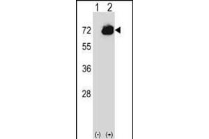 Western blot analysis of CTPS2 (arrow) using rabbit polyclonal CTPS2 Antibody (C-term) (ABIN656954 and ABIN2846140). (CTPS2 Antikörper  (C-Term))