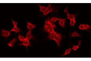 ABIN6268846 staining HT29 by IF/ICC. (TANK Antikörper  (Internal Region))