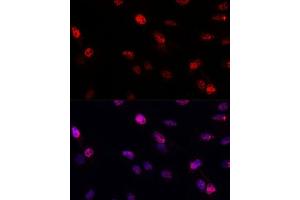 Immunofluorescence analysis of C6 cells using BRC antibody (1318) at dilution of 1:100. (BRCA1 Antikörper  (AA 400-699))