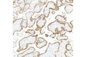 Immunohistochemistry (IHC) image for anti-Epidermal Growth Factor Receptor (EGFR) (AA 1100-1150) antibody (ABIN7795640) (Rekombinanter EGFR Antikörper  (AA 1100-1150))