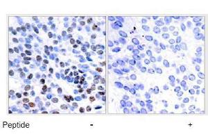 Image no. 1 for anti-Jun B Proto-Oncogene (JUNB) (Ser259) antibody (ABIN197141) (JunB Antikörper  (Ser259))