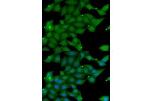 Immunofluorescence analysis of U2OS cells using RASGRF1 antibody (ABIN5974188). (RASGRF1 Antikörper)