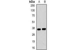 Western blot analysis of Tropomyosin 3 expression in mouse lung (A), mouse heart (B) whole cell lysates. (TPM3 Antikörper)