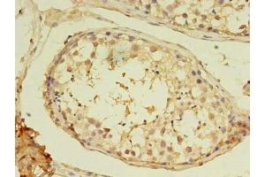 Immunohistochemistry (IHC) image for anti-Myosin, Heavy Chain 7B, Cardiac Muscle, beta (MYH7B) (AA 1-176) antibody (ABIN7160592)