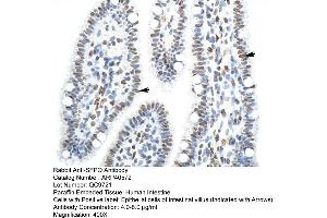 Rabbit Anti-SFPQ Antibody  Paraffin Embedded Tissue: Human Intestine Cellular Data: Epithelial cells of intestinal villas Antibody Concentration: 4. (SFPQ Antikörper  (N-Term))