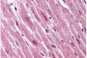 Human Heart (formalin-fixed, paraffin-embedded) stained with ADAMTS4 antibody ABIN290074 at 2. (ADAMTS4 Antikörper  (Internal Region))