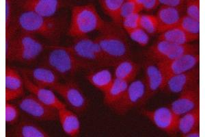 IF analysis of RPS15A using anti-RPS15A antibody (ABIN7598954). (RPS15A Antikörper  (AA 1-113))