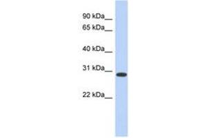 Image no. 1 for anti-Homeobox D12 (HOXD12) (AA 179-228) antibody (ABIN6742239) (HOXD12 Antikörper  (AA 179-228))
