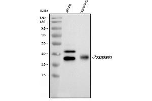 Western blot analysis of Podoplanin/gp36 using anti-Podoplanin/gp36 antibody (ABIN3043111).