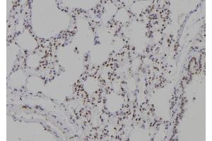 ABIN6277236 at 1/100 staining Rat lung tissue by IHC-P.