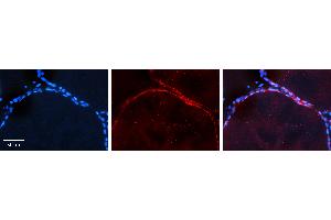 Rabbit Anti-AKT2 Antibody   Formalin Fixed Paraffin Embedded Tissue: Human Thyroid Tissue Observed Staining: Plasma membrane in follicular cells Primary Antibody Concentration: 1:100 Other Working Concentrations: 1:600 Secondary Antibody: Donkey anti-Rabbit-Cy3 Secondary Antibody Concentration: 1:200 Magnification: 20X Exposure Time: 0. (AKT2 Antikörper  (Middle Region))