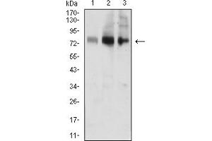 Western blot analysis using ACSS1 mouse mAb against MOLT4 (1), Jurkat (2), and HL-60 (3) cell lysate. (ACSS1 Antikörper  (AA 548-689))