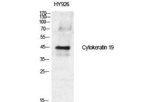 Western Blot (WB) analysis of specific cells using Cytokeratin 19 Polyclonal Antibody. (Cytokeratin 19 Antikörper  (Internal Region))