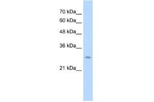 WB Suggested Anti-UBE2J2 Antibody Titration:  1. (UBE2J2 Antikörper  (C-Term))