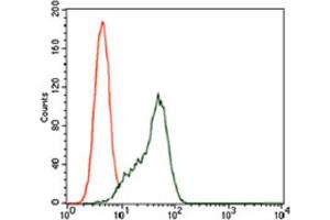 Immunohistochemical analysis of paraffin-embedded rectum cancer tissues using STAT5A antibody with DAB staining. (STAT5A Antikörper  (AA 583-794))
