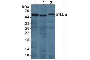 Figure. (Prothrombin Fragment 1+2 Antikörper  (AA 44-327))