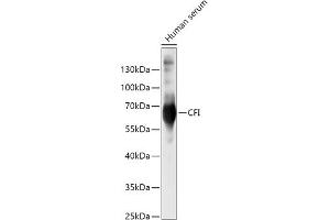 Western blot analysis of extracts of Human serum, using CFI antibody (ABIN6127713, ABIN6138461, ABIN6138462 and ABIN6221257) at 1:500 dilution. (Complement Factor I Antikörper  (AA 19-300))