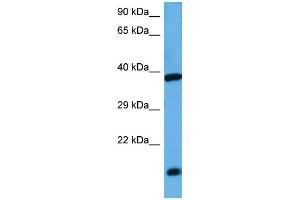 Western Blotting (WB) image for anti-Activating Transcription Factor 4 (Tax-Responsive Enhancer Element B67) (ATF4) (N-Term) antibody (ABIN2780377)