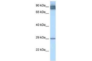 Western Blot showing LRAT antibody used at a concentration of 1. (LRAT Antikörper  (N-Term))