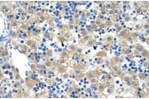 Immunohistochemical staining (Formalin-fixed paraffin-embedded sections) of human liver with FERD3L polyclonal antibody  at 4-8 ug/mL working concentration. (FERD3L Antikörper  (N-Term))