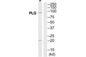 Western blot analysis of extracts from Jurkat cells, using PLG antibody. (PLG Antikörper  (N-Term))
