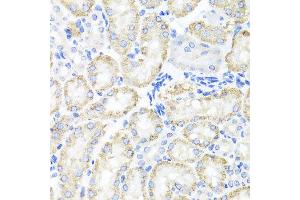Immunohistochemistry of paraffin-embedded mouse kidney using SPICE1 antibody at dilution of 1:100 (x40 lens). (SPICE1 Antikörper)