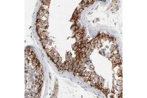 Immunohistochemical staining of human testis with ITPR3 polyclonal antibody  shows cytoplasmic positivity in cells in seminiferus ducts at 1:200-1:500 dilution. (ITPR3 Antikörper)