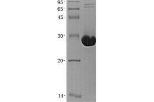Validation with Western Blot (CA13 Protein)