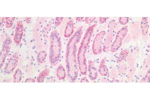 Immunohistochemistry (IHC) image for anti-Cadherin 1, Type 1, E-Cadherin (Epithelial) (CDH1) (AA 373-621) antibody (ABIN7425608)
