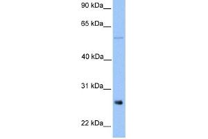 WB Suggested Anti-METTL7B Antibody Titration:  0. (METTL7B Antikörper  (Middle Region))