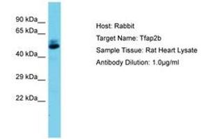 Image no. 1 for anti-Transcription Factor AP-2 beta (Activating Enhancer Binding Protein 2 Beta) (TFAP2B) (AA 104-153) antibody (ABIN6750458) (TFAP2B Antikörper  (AA 104-153))